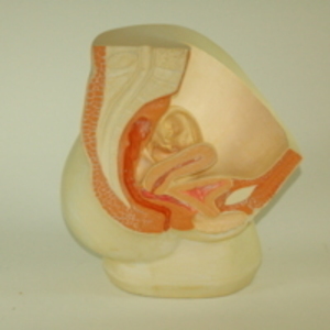 Dickinson-Belskie style model of female pelvis, 1945-2007