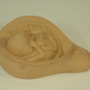 Dickinson-Belskie model of a fetus in uterus, 1945-2007