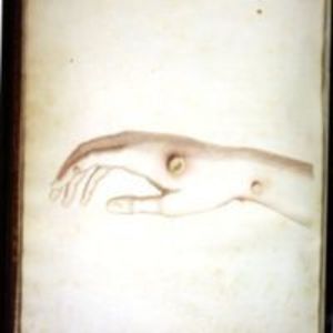 Hand of Sarah Nelmes