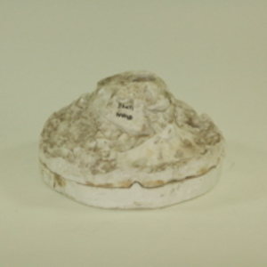 Dickinson-Belskie pelvis mold, 1939-1950