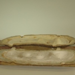 Dickinson-Belskie mold of interior of five uteri, 1939-1950