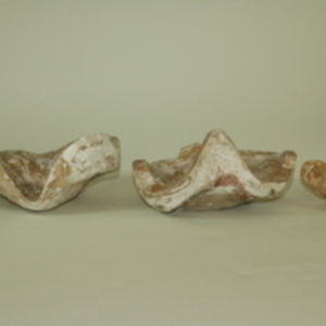 Dickinson-Belskie mold of female pelvis, 1948