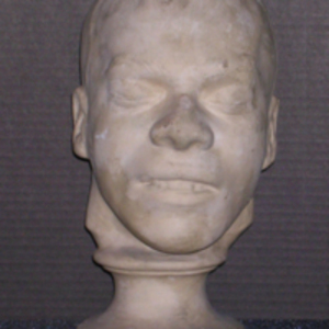 Phrenology cast of head of William Corder, 1828-1832