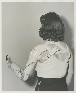 A patient with a prosthetic limb