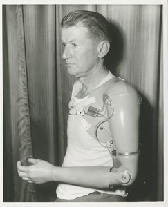 Donald Logan demonstrates an arm prosthetic