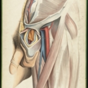 Teaching watercolor of the coverings of the sac of an oblique or external inguinal hernia