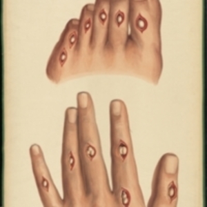 Teaching watercolor of the superficial bursae over the joints of the fingers and toes