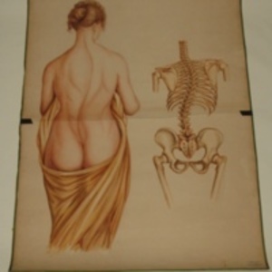 Teaching watercolor of a woman and her skeleton, after John Shaw's Distortions of Spine, by Oscar Wallis, 1848-1854