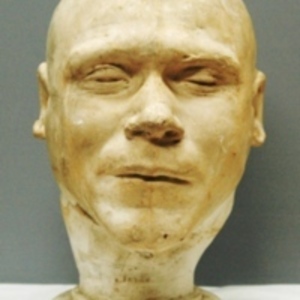 Head Cast of William Burke, 1829 [WAM 03386.002]