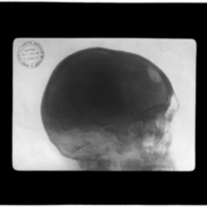 X-ray of skull in profile