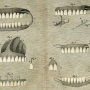 A Dissertation on Artificial Teeth