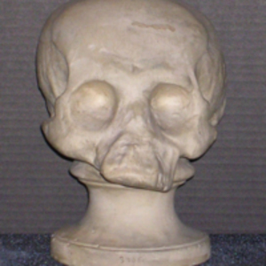Phrenology cast of skull of Native American individual, 1812-1845