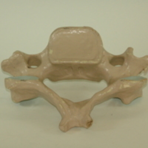 Dwight-Emerton papier-mache model of cervical vertebra, 1890-1895