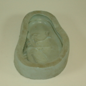 Dickinson-Belskie rubber mold of fetus, 1945-2007