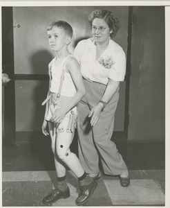 A physical therapist helps a young boy practice walking with his prosthetic leg