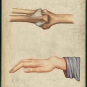 Teaching watercolor of the dislocation of the elbow and wrist