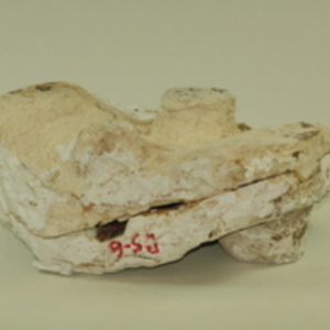 Dickinson-Belskie pelvis mold, 1939-1950