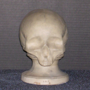 Phrenology cast of skull of Madeline Albert, 1811-1835