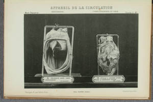 [Collotype plates in Catalogue des pièces du Musée Dupuytren, Atlas du Tome Quatrième]