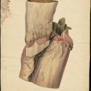 Teaching watercolor of bone and tissue