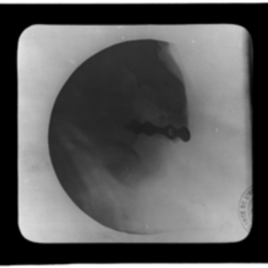 Round x-ray of strange shaped metal piece