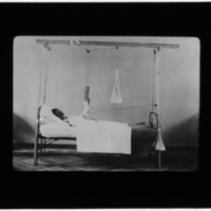 Patient in bed with arm in cast raised with pulley