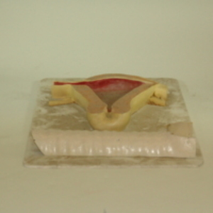 Dickinson-Belskie style model of large uterus, 1945-2007