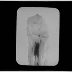 X-ray of unknown subject