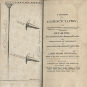 A treatise on acupuncturation