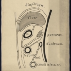 Teaching watercolor of the development of the peritoneum