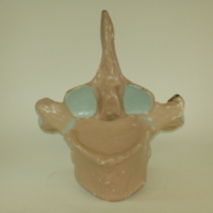 Dwight-Emerton papier-mache model of thoracic vertebra, 1890-1895