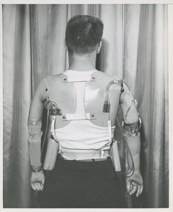 A man missing both of his arms shows his prosthetic device from the back