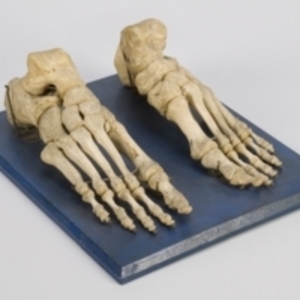 Healthy right and left foot bones of an adult, mounted to illustrate the sesamoids