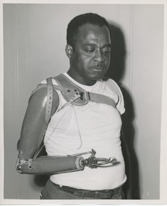 Man wearing artificial arm