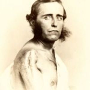 Man with resectioned shoulder joint, labelled in ink on verso.