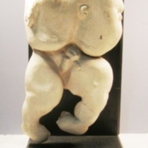 Plaster cast of acephalic fetus