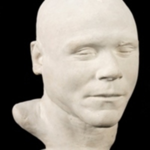 Phrenology cast of head of William Burke