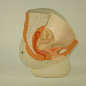 Dickinson-Belskie style model of female pelvis, 1945-2007
