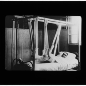 Patient in bed with leg in cast raised in slings