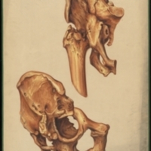 Teaching watercolor of pelvis and femur