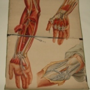 Teaching watercolor of arteries of the arm and hand, after Richard Quain's The Anatomy of the Arteries of the Human Body, 1848-1854