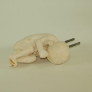 Dickinson-Belskie model of fetus, 1939-1950
