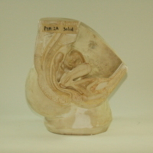 Replica of Dickinson-Belskie model of sectioned female reproductive anatomy, 1945-2007