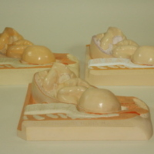 Replicas of Dickinson-Belskie model of Birth Series eleven, 1967