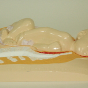 Replica of Dickinson-Belskie model of Birth Series thirteen, 1967