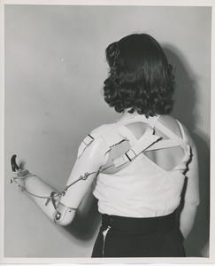 Woman with artificial arm
