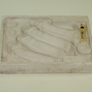 Dickinson-Belskie model of male genitalia, 1939-1950