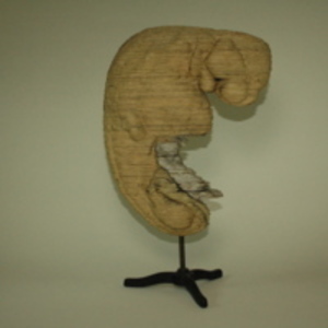 Human embryo model, 1913-1956