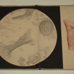 Teaching watercolor of human tissue, external and microscopic views, 1848-1854