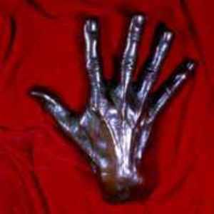 Cast of the Hand of Harvey Cushing